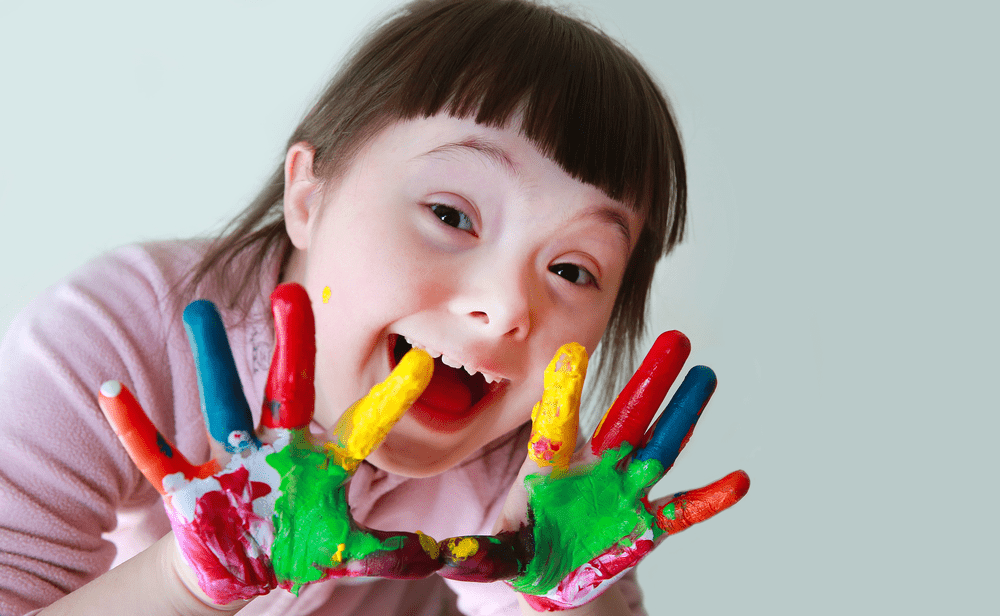 “Down Sendromu bir eksiklik değil, genetik bir varyasyondur”